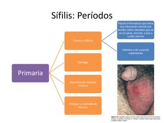Sífilis: Períodos
Primaria
Chancro sifilítico
Pápula eritematosa que tiene
una ulceración central con
bordes sobre elevados que se
ve en pene, escroto, vulva o
cuello uterino
Indoloro y de curación
espontanea
Contagia
Diseminación Hemato
Linfatica
Prosigue un periodo de
latencia
 