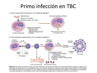 Primo infección en TBC
 