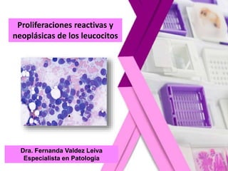 Proliferaciones reactivas y
neoplásicas de los leucocitos
Dra. Fernanda Valdez Leiva
Especialista en Patología
 