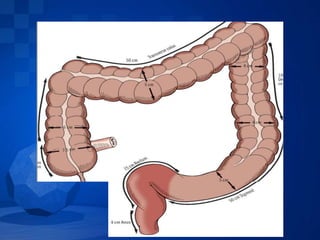Patologia maligna del colon
