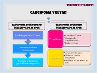 
Carcinoma vulvar
Carcinoma escamoso noCarcinoma escamoso no
relacionado al VPH:relacionado al VPH:
Carcinoma escamosoCarcinoma escamoso
relacionado al VPH:relacionado al VPH:
Tumores invasores
 