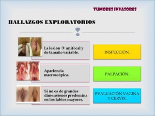 
HALLAZGOS EXPLORATORIOS
INSPECCIÓN.
PALPACIÓN.
EVALUACIÓN VAGINA
Y CERVIX.
Tumores invasores
 