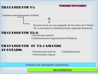 
TRATAMIENTO T1:
Lesiones microinvasoras (<1mm)
Escisión local con un manguito de Tej. Sano de 5-10mm
No es necesaria la linfadenectomia inguinal ipsilateral.
TRATAMIENTO T2-3:
Vulvectomía radical.
Linfadenectomia inguinofemoral bilateral.
Tumores con adenopatías sospechosas.Tumores con adenopatías sospechosas.
SEGUIMIENTO.
TRATAMIENTO TU T3-4 GRANDE
AVANZADO: •Exenteracion pelvica. Linfadenectomia.
•Vulvectomia radical.
Tumores invasores
 