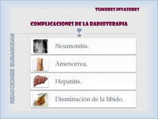 
Complicaciones de la RADIOTERAPIA
Tumores invasores
 