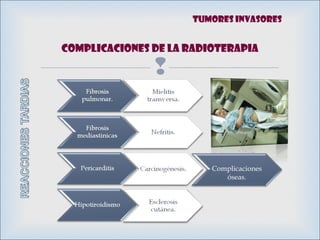 
Complicaciones de la RADIOTERAPIA
Complicaciones
óseas.
Tumores invasores
 