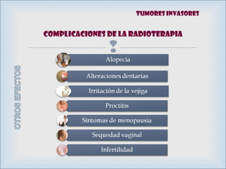 
Complicaciones de la RADIOTERAPIA
Tumores invasores
 