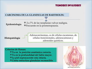 
CARCINOMA DE LA GLANDULAS DE BARTHOLIN:
Epidemiología
 2 a 7% de las neoplasias vulvar maligna.
Frecuente en la posmenopausia.
HistopatologíaHistopatología
Criterios de Honan:
Tu en la posición anatómica correcta.
Tu en la profundidad del labio mayor.
La piel suprayacente esta intacta.
Cierta estructura glandular reconocible.
Criterios de Honan:
Tu en la posición anatómica correcta.
Tu en la profundidad del labio mayor.
La piel suprayacente esta intacta.
Cierta estructura glandular reconocible.
Adenocarcinomas, ca de células escamosas, de
células trancisionales, adenoscamosos y
adenoides quísticos.
Tumores invasores
 