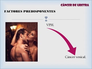 
FACTORES PREDISPONENTES
Cáncer de uretra
 