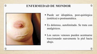 ENFERMEDAD DE MONDOR
 Puede ser idiopática, post-quirúrgica
(estética) o postraumática.
 Es doloroso, autolimitado. Se trata con
analgésicos.
 Los surcos venosos pueden acentuarse
traccionando suavemente la piel hacia
abajo.
 