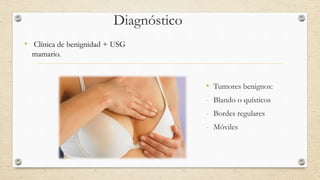 Diagnóstico
• Clínica de benignidad + USG
mamario.
• Tumores benignos:
- Blando o quísticos
- Bordes regulares
- Móviles
 
