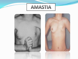 ANORMALIDADES DE CRECIMIENTO Y DESARROLLO