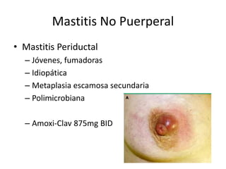 Mastitis No Puerperal
• Mastitis Periductal
– Jóvenes, fumadoras
– Idiopática
– Metaplasia escamosa secundaria
– Polimicrobiana
– Amoxi-Clav 875mg BID
 