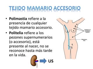 • Polimastia refiere a la
presencia de cualquier
tejido mamario accesorio.
• Politelia refiere a los
pezones supernumerarios
(o accesorio), está
presente al nacer, no se
reconoce hasta más tarde
en la vida.
US
 