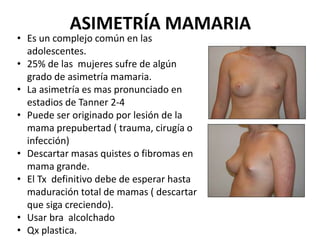 ASIMETRÍA MAMARIA
• Es un complejo común en las
adolescentes.
• 25% de las mujeres sufre de algún
grado de asimetría mamaria.
• La asimetría es mas pronunciado en
estadios de Tanner 2-4
• Puede ser originado por lesión de la
mama prepubertad ( trauma, cirugía o
infección)
• Descartar masas quistes o fibromas en
mama grande.
• El Tx definitivo debe de esperar hasta
maduración total de mamas ( descartar
que siga creciendo).
• Usar bra alcolchado
• Qx plastica.
 