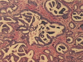 PATOLOGIA MAMÁRIA.ppt