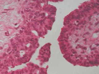 PATOLOGIA MAMÁRIA.ppt