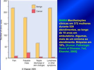 MAMA Manifestações
clínicas em 372 mulheres
durante 539
atendimentos, ao longo
de 10 anos em
ambulatório. Algumas,
mais de um sintoma ao
atendimento. Biópsias em
10%. [Kumar. Pathologic
Basis of Disease, 7ed,
Elsevier, 2005]
 