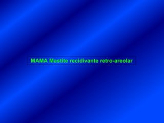 MAMA Mastite recidivante retro-areolar
 
