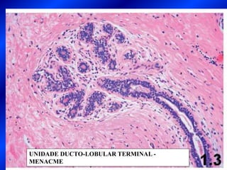 UNIDADE DUCTO-LOBULAR TERMINAL -
MENACME
 