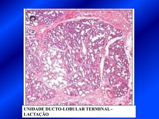 UNIDADE DUCTO-LOBULAR TERMINAL -
LACTAÇÃO
 