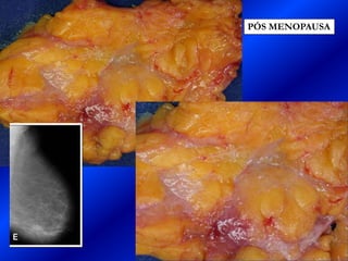 PÓS MENOPAUSA
 