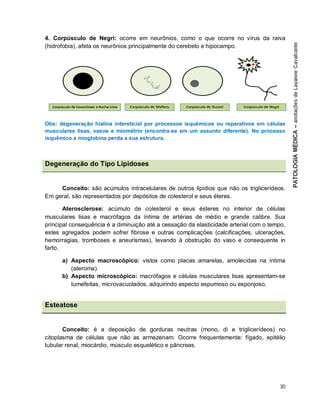 30
4. Corpúsculo de Negri: ocorre em neurônios, como o que ocorre no vírus da raiva
(hidrofobia), afeta os neurônios principalmente do cerebelo e hipocampo.
Obs: degeneração hialina intersticial por processos isquêmicos ou reparativos em células
musculares lisas, vasos e miométrio (encontra-se em um assunto diferente). No processo
isquêmico a mioglobina perda a sua estrutura.
Degeneração do Tipo Lipidoses
Conceito: são acúmulos intracelulares de outros lipídios que não os triglicerídeos.
Em geral, são representados por depósitos de colesterol e seus éteres.
Aterosclerose: acúmulo de colesterol e seus ésteres no interior de células
musculares lisas e macrófagos da íntima de artérias de médio e grande calibre. Sua
principal consequência é a diminuição até a cessação da elasticidade arterial com o tempo,
estes agregados podem sofrer fibrose e outras complicações (calcificações, ulcerações,
hemorragias, tromboses e aneurismas), levando à obstrução do vaso e consequente in
farto.
a) Aspecto macroscópico: vistos como placas amarelas, amolecidas na íntima
(ateroma).
b) Aspecto microscópico: macrófagos e células musculares lisas apresentam-se
tumefeitas, microvacuolados, adquirindo aspecto espumoso ou esponjoso.
Esteatose
Conceito: é a deposição de gorduras neutras (mono, di e triglicerídeos) no
citoplasma de células que não as armazenam. Ocorre frequentemente: fígado, epitélio
tubular renal, miocárdio, músculo esquelético e pâncreas.
 
