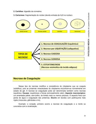 34
2. Cariólise: digestão da cromatina.
3. Cariorrexe: fragmentação do núcleo (devido entrada de H2O no núcleo).
Necrose de Coagulação
Nesse tipo de necrose modifica a consistência do citoplasma que se coagula
(solidifica), pois as proteínas intracelulares do citoplasma encontram-se normalmente em
estado de gel. A necrose se coagulação pode ser denominada também como necrose
isquêmica. Causas: isquêmicas e físicas (principalmente calor). Aspecto macroscópico:
cor amarelada pálida, sem brilho, de limites mais ou menos precisos. O aspecto físico por
perda de água e coagulação das proteínas. Ocorre em tecidos com parênquima mais
rígido (músculos, glândulas e rim).
Exemplo: o coração, primeiro ocorre a necrose de coagulação e a morte se
concretiza com a cicatrização.
 