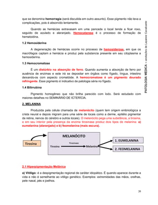 39
que se denomina hemorragia (será discutida em outro assunto). Esse pigmento não leva a
complicações, pois é absorvido lentamente.
Quando as hemácias extravasam em uma pancada o local tende a ficar roxo,
seguido de azulado e alaranjado. Hemocatarese é o processo de formação de
hematoidina.
1.2 Hemosiderina
A degeneração de hemácias ocorre no processo de hemosiderose, em que os
macrófagos captam a hemácia e produz pela substancia presente em seu citoplasma a
hemosiderina.
1.3 Hemocromatose
É um distúrbio na absorção de ferro. Quando aumenta a absorção de ferro por
ausência de enzimas e este irá se depositar em órgãos como fígado, língua, intestino
deixando-os com aspecto cromatóide. A hemocromatose é um pigmento dourado
refringente. Esse pigmento é indicativo de patologia séria no fígado.
1.4 Bilirrubina
Pigmento homogêneo que não brilha parecido com lodo. Será estudado com
maiores detalhes no SEMINÁRIO DE ICTERÍCIA.
2. MELANINA
Produzida pela célula chamada de melanócito (quem tem origem embriológica a
crista neural e depois migram para uma série de locais como a derme, epitélio pigmentar
da retina, nervos do cérebro e outros locais). O melanócito pega uma substância, a tirosina,
e em seu interior pela presença da enzima tirosinase produz dois tipos de melanina: a)
eumelanina (alaranjado) e b) feomelanina (mais escura).
2.1 Hiperpigmentação Melânica
a) Vitiligo: é a despigmentação regional de caráter idiopático. É quando aparece durante a
vida e não é semelhante ao vitiligo genético. Exemplos: extremidades das mãos, orelhas,
pele nasal, pés e joelhos.
 