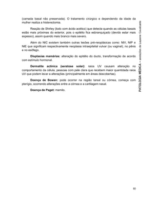 80
(camada basal não preservada). O tratamento cirúrgico e dependendo da idade da
mulher realiza a histerectomia.
Reação de Shirley (Iodo com ácido acético) que detecta quando as células basais
estão mais próximas do exterior, pois o epitélio fica esbranquiçado (devido estar mais
espesso), assim quando mais branco mais severo.
Além do NIC existem também outras lesões pré-neoplásicas como: NIV, NIP e
NIE que significam respectivamente neoplasia intraepitelial vulvar (ou vaginal), no pênis
e no esôfago.
Displasias mamárias: alteração do epitélio do ducto, transformação de acordo
com estímulo hormonal.
Dermatite actínica (seratose solar): raios UV causam alteração no
comportamento da célula, pessoas com pele clara que recebem maior quantidade raios
UV que podem levar a alterações (principalmente em áreas descobertas).
Doença de Bowen: pode ocorrer na região tarsal ou córnea, começa com
pterígio, ocorrendo alterações entre a córnea e a cartilagem nasal.
Doença de Paget: mamilo.
 