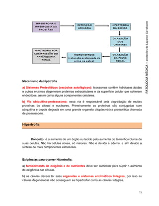 15
Mecanismo da hipotrofia
a) Sistemas Proteolíticos (vacúolos autofágicos): lisossomos contêm hidrolases ácidas
e outras enzimas degeneram proteínas extracelulares e da superfície celular que sofreram
endocitose, assim como alguns componentes celulares.
b) Via ubiquitina-proteassoma: essa via é responsável pela degradação de muitas
proteínas do citosol e nucleares. Primeiramente as proteínas são conjugadas com
ubiquitina e depois degrada em uma grande organela citoplasmática proteolítica chamada
de proteassoma.
Hipertrofia
Conceito: é o aumento de um órgão ou tecido pelo aumento do tamanho/volume de
suas células. Não há células novas, só maiores. Não é devido a edema, e sim devido a
síntese de mais componentes estruturais.
Exigências para ocorrer Hipertrofia:
a) fornecimento de oxigênio e de nutrientes deve ser aumentar para suprir o aumento
de exigência das células.
b) as células devem ter suas organelas e sistemas enzimáticos íntegros, por isso as
células degeneradas não conseguem se hipertrofiar como as células íntegras.
 