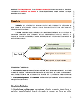 18
formando células poliplóides. É um processo reversível ao cessar o estímulo, mas após
ultrapassar o ponto de não retorno as células hipertrofiadas sofrem necrose e o órgão
entra em insuficiência.
Hipoplasia
Conceito: é a diminuição do tamanho do órgão pela diminuição da quantidade de
suas células. A região afetada é menor e menos pesada do que o normal, mas conserva o
padrão arquitetural básico.
Causas: durante a embriogênese pode ocorrer defeito da formação de um órgão ou
parte dele (hipoplasia renal, pulmonar). Após o nascimento ocorre como resultado da
diminuição do ritmo de renovação celular, aumento da taxa de destruição das células ou
ambos os fenômenos.
Hipoplasias Fisiológicas
1. Involução do timo: ocorre a partir da puberdade; é um órgão importante para imunidade,
quando os linfócitos T vão ao timo sofrer maturação (marcação) ao saírem o deixam menor,
tendo maior volume do RN. A diminuição do tamanho não traz problemas para o organismo.
2. Involução das gônadas no climatério: ocorre diminuição hormonal, levando diminuição
das gônadas (tecido alvo).
Hipoplasias Patológicas
1. Hipoplasia da medula óssea: provocada por infecções ou agentes tóxicos (como os
agrícolas, organofosforados), levando diminuição da medula, que forma as células
 