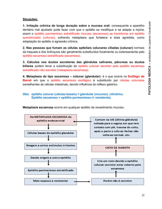 22
Situações:
1. Irritação crônica de longa duração sobre a mucosa oral: consequente a aparelho
dentário mal ajustado pode fazer com que o epitélio se modifique e se adapte a injúria,
assim o epitélio pavimentoso estratificado mucoso (escamoso) se transforma em epitélio
queratinizado (colunar), sofrendo metaplasia que fortalece a área agredida, como
adaptação do epitélio à agressão crônica.
2. Nas pessoas que fumam as células epiteliais colunares ciliadas (colunar) normais
da traqueia e dos brônquios são geralmente substituídos focalmente ou extensamente pelo
epitélio escamoso estratificado (escamoso).
3. Cálculos nos ductos excretores das glândulas salivares, pâncreas ou ductos
biliares podem levar a substituição do epitélio colunar secretor pelo epitélio escamoso
estratificado não secretor (metaplasia escamosa).
4. Metaplasia do tipo escamosa – colunar (glandular): é o que ocorre no Esôfago de
Barret em que o epitélio escamoso esofágico é substituído por células colunares
semelhantes às células intestinais, devido influência do reflexo gástrico.
Obs: epitélio colunar (células basais) = glandular (mucoso), cilíndrico.
Epitélio escamoso = epitélio pavimentoso (+ resistente).
Metaplasia escamosa ocorre em qualquer epitélio de revestimento mucoso.
 