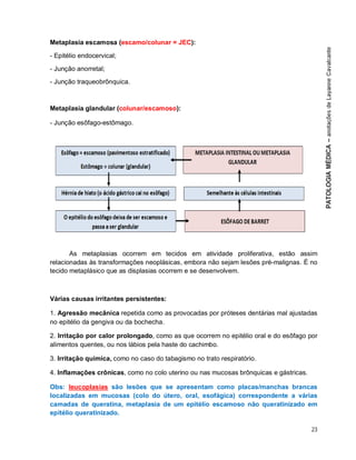 23
Metaplasia escamosa (escamo/colunar = JEC):
- Epitélio endocervical;
- Junção anorretal;
- Junção traqueobrônquica.
Metaplasia glandular (colunar/escamoso):
- Junção esôfago-estômago.
As metaplasias ocorrem em tecidos em atividade proliferativa, estão assim
relacionadas às transformações neoplásicas, embora não sejam lesões pré-malignas. É no
tecido metaplásico que as displasias ocorrem e se desenvolvem.
Várias causas irritantes persistentes:
1. Agressão mecânica repetida como as provocadas por próteses dentárias mal ajustadas
no epitélio da gengiva ou da bochecha.
2. Irritação por calor prolongado, como as que ocorrem no epitélio oral e do esôfago por
alimentos quentes, ou nos lábios pela haste do cachimbo.
3. Irritação química, como no caso do tabagismo no trato respiratório.
4. Inflamações crônicas, como no colo uterino ou nas mucosas brônquicas e gástricas.
Obs: leucoplasias são lesões que se apresentam como placas/manchas brancas
localizadas em mucosas (colo do útero, oral, esofágica) correspondente a várias
camadas de queratina, metaplasia de um epitélio escamoso não queratinizado em
epitélio queratinizado.
 