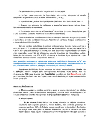 27
Os agentes lesivos provocam a degeneração hidrópica por:
a) hipóxia, desacopladores da fosforilação mitocondrial, inibidores da cadeia
respiratória e agentes tóxicos que lesam a mitocôndria (< ATP);
b) hipertermia exógena ou endógena (febre), por causa do > do consumo de ATP;
c) Toxinas com atividade de fosfolipase e agressões geradoras de radicais livres,
que lesam diretamente a membrana;
d) Substâncias inibidoras da ATPase Na+
/K+
dependente (é o caso da ouabaína, que
é uma substância usada no tratamento da insuficiência cardíaca).
Todas acima levam a um fenômeno comum: retenção de sódio, redução de potássio
e aumento da pressão osmótica intracelular. Assim levam a entrada de água no citoplasma
e expansão isosmótica da célula.
Com as bombas eletrolíticas do retículo endoplasmático liso são mais sensíveis à
redução de ATP. O primeiro comportamento é expansão celular, em seguida expande o
Citosol. Isso provoca rearranjo na distribuição das organelas citoplasmáticas que ficam
mais separadas conferindo ao citoplasma aspecto granuloso ao microscópico óptico.
Dilatação das cisternas dos REL e RER. O grande acúmulo de água no citosol é o que
conferem o aspecto vacuolar característico da lesão.
Obs: segundo o professor as causas que levam aos distúrbios da Bomba de Na+
/K+
tem
como primeira manifestação: a mitocôndria deixa de produzir energia provocando entrada de
Na+
para tentar fazer funcionar. Exemplo: na isquemia por obstrução arterial.
A degeneração hidrópica é mais frequente em células parenquimatosas (fígado, rim
e coração). Quase sempre sem consequências funcionais muito sérias, mas na
degeneração hidrópica intensa nos hepatócitos considera do tipo Baloniforme pode
produzir alterações funcionais nos órgãos, mas a insuficiência hepática por lesão exclusiva
desse tipo é rara.
Aspectos Morfológicos
a) Macroscópica: os órgãos aumento o peso e volume (tumefação), as células
estão mais pálidas (> leva a compressão de capilares) e ocorre perda do brilho (turvo). As
células estão mais salientes na superfície do órgão (fato bem observado no fígado).
b) Microscópica:
1) No microscópico óptico: em lesões discretas as células tumefeitas,
citoplasma com aspecto granuloso, menos basófilo, mais acidófilo, presença de
pequenos vacúolos (RE e C.Golgi) e pequenos grânulos (mitocôndrias). Em lesões
de estágio mais avançados as células apresentam pequenos vacúolos de água
distribuídos de modo regular no citoplasma (podendo ser confundidos com esteatose
 