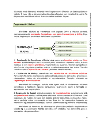 29
escamoso (mais resistente) deixando o muco aprisionado, formando um cisto/lago/cisto de
Naboth. O muco não se cora normalmente pelas colorações com hematoxilina-eosina. Na
degeneração mucóide as células ficam em anel de sinete ou de grau.
Degeneração Hialina
Conceito: acúmulo de substâncias com aspecto vítreo e material acidófilo,
macroscopicamente: compacta, homogênea, com certa transparência e brilho. Esse
tipo de degeneração encontra-se na forma de corpúsculos.
1. Corpúsculo de Councilman e Rocha Lima: ocorre em hepatites virais e na febre
amarela. Apresenta hepatócitos com diminuição do tamanho do citoplasma hialino, solto da
trabécula e com núcleos picnóticos, fragmentados ou ausentes. Ocorrem agregados de
mitocôndrias, coagulação proteínas, esférica, corados intensamente pela eosina. Também
conhecido como Corpúsculo de Crosman (descobriu na febre amarela).
2. Corpúsculo de Mallory: encontrado nos hepatócitos de alcoólatras crônicos.
Apresentam filamentos intermediários (citoceratinas) associados com outras proteínas do
citoesqueleto, restos de microtúbulos e microfilamentos. Também chamado de
Degeneração Hialina Alcoólica.
Mecanismo de formação: radicais livres agem sobre as citoceratinas induzindo
peroxidação e facilitando ligações transversais, favorecendo assim a formação de
aglomerados, que se precipitam.
3. Corpúsculo de Russel: acúmulo excessivo de imunoglobulinas (principalmente IgG)
nos plasmócitos levando à formação de estruturas intracitoplasmáticas conhecidas como
corpúsculos de Russel. Às vezes com aspecto globular eosinofílico, deslocando o núcleo
para a periferia, outras com aspecto morular. Esse tipo de corpúsculo é frequente em
inflamações agudas (salmonelases) ou crônicas (leishmaniose tegumentar e osteomielites).
Mecanismo de formação: ao envelhecer os plasmócitos perdem a capacidade de
secretar Ig e as acumulam, ficando parecidos com eritrócitos, mas sem brilho, pois os
plasmócitos não possuem ferro.
 