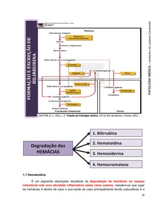 38
1.1 Hematoidina
É um pigmento alaranjado resultante da degradação de hemácias no espaço
intersticial sob uma atividade inflamatória pelos raios solares, ressalva-se que lugar
de hemácias é dentro de vaso e sua saída do vaso principalmente tecido subcutâneo é o
 