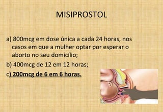 MISIPROSTOL
a) 800mcg em dose única a cada 24 horas, nos
casos em que a mulher optar por esperar o
aborto no seu domicílio;
b) 400mcg de 12 em 12 horas;
c) 200mcg de 6 em 6 horas.
 