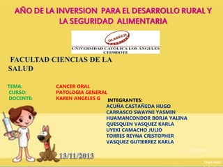 AÑO DE LA INVERSION PARA EL DESARROLLO RURAL Y
LA SEGURIDAD ALIMENTARIA

FACULTAD CIENCIAS DE LA
SALUD
TEMA:
CURSO:
DOCENTE:

CANCER ORAL
PATOLOGIA GENERAL
KAREN ANGELES G INTEGRANTES:

ACUÑA CASTAÑEDA HUGO
CARRASCO SWAYNE YASMIN
HUAMANCONDOR BORJA YALINA
QUESQUEN VASQUEZ KARLA
UYEKI CAMACHO JULIO
TORRES REYNA CRISTOPHER
VASQUEZ GUTIERREZ KARLA

1

10/12/2013

 