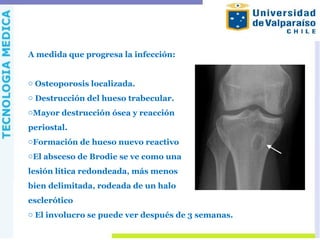 A medida que progresa la infección:
o Osteoporosis localizada.
o Destrucción del hueso trabecular.
oMayor destrucción ósea y reacción
periostal.
oFormación de hueso nuevo reactivo
oEl absceso de Brodie se ve como una
lesión lítica redondeada, más menos
bien delimitada, rodeada de un halo
esclerótico
o El involucro se puede ver después de 3 semanas.
 