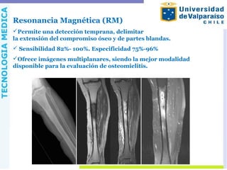 Resonancia Magnética (RM)
Permite una detección temprana, delimitar
la extensión del compromiso óseo y de partes blandas.
 Sensibilidad 82%- 100%. Especificidad 75%-96%
Ofrece imágenes multiplanares, siendo la mejor modalidad
disponible para la evaluación de osteomielitis.
 