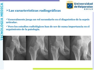 Las características radiográficas
Generalmente juega un rol secundario en el diagnóstico de la sepsis
articular.
Pero los estudios radiológicos han de ser de suma importancia en el
seguimiento de la patología.
 