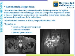 Resonancia Magnética
Permite visualización y determinación del compromiso de tejidos
intraarticulares como cartílago, sinovial y de partes adyacentes como
el hueso, ligamentos y músculos, en etapas tan tempranas como a las
24 horas del comienzo de la infección .
Sensibilidad cercana al 100% y especificidad del 77%
Sensible a:
o Daño cartilaginoso temprano
o Refuerzo sinovial
o Edema peri-sinovial
 