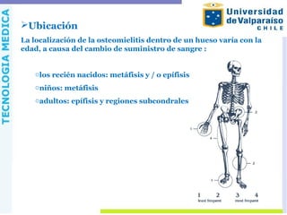 Ubicación
La localización de la osteomielitis dentro de un hueso varía con la
edad, a causa del cambio de suministro de sangre :
olos recién nacidos: metáfisis y / o epífisis
oniños: metáfisis
oadultos: epífisis y regiones subcondrales
 
