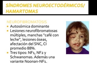 NEUROFIBROMATOSISNEUROFIBROMATOSIS
 Autosómica dominante
 Lesiones neurofibromatosas
múltiples, manchas “café con
leche”, lesiones óseas,
afectación del SNC, CI
promedio 88%.
 Tres tipos: NF1, NF2 y
Schwanomas.Además una
variante Noonan-NF1.
 
