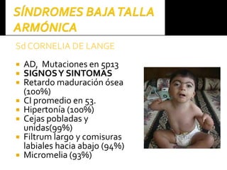 SdSd CORNELIA DE LANGECORNELIA DE LANGE
 AD, Mutaciones en 5p13
 SIGNOSY SINTOMAS
 Retardo maduración ósea
(100%)
 CI promedio en 53.
 Hipertonía (100%)
 Cejas pobladas y
unidas(99%)
 Filtrum largo y comisuras
labiales hacia abajo (94%)
 Micromelia (93%)
 
