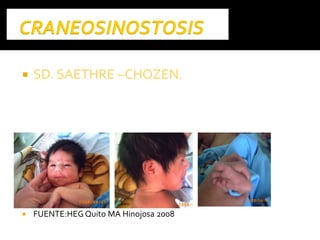  SD. SAETHRESD. SAETHRE ––CHOZEN.CHOZEN.
 FUENTE:HEG Quito MA Hinojosa 2008
 