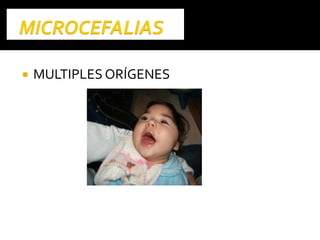  MULTIPLES ORÍGENES
 