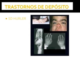  SD HURLERSD HURLER
 