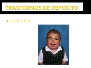  SD HUNTERSD HUNTER
 