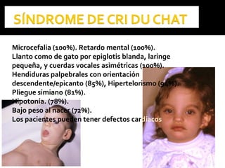 Microcefalia (100%). Retardo mental (100%).
Llanto como de gato por epiglotis blanda, laringe
pequeña, y cuerdas vocales asimétricas (100%).
Hendiduras palpebrales con orientación
descendente/epicanto (85%), Hipertelorismo (94%).
Pliegue simiano (81%).
Hipotonía. (78%).
Bajo peso al nacer (72%).
Los pacientes pueden tener defectos cardíacos
 